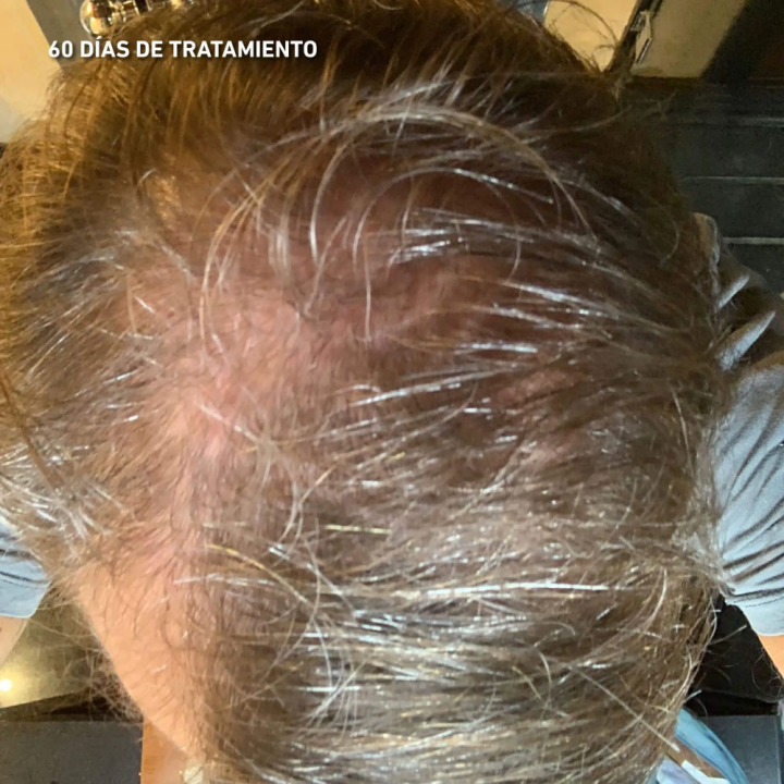 Loción Anticaída Hey Joe 150ml