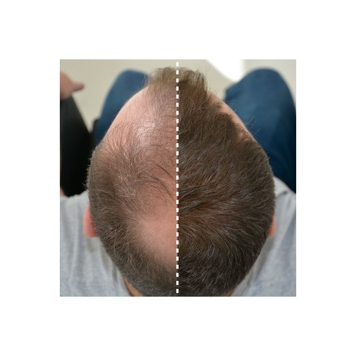 Fibras Capilares con Keratina Color Negro 25 g